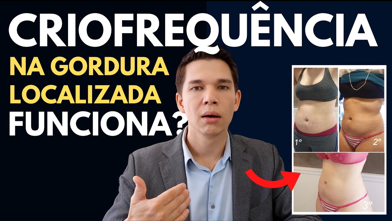 Criofrequência para Gordura Localizada e Flacidez - FUNCIONA MESMO?