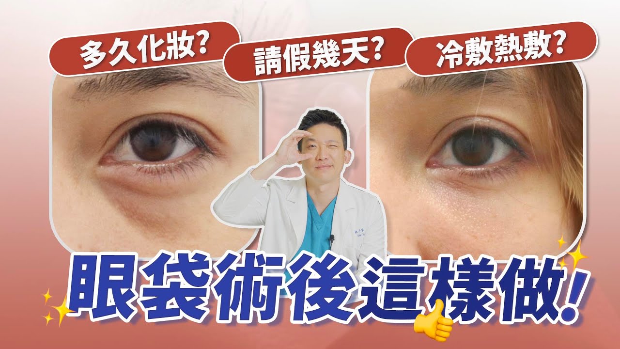眼袋手術前必看❗️局部麻醉會痛嗎？恢復期多久？隔天上班可能嗎？｜新聖整形外科 林子宇醫師