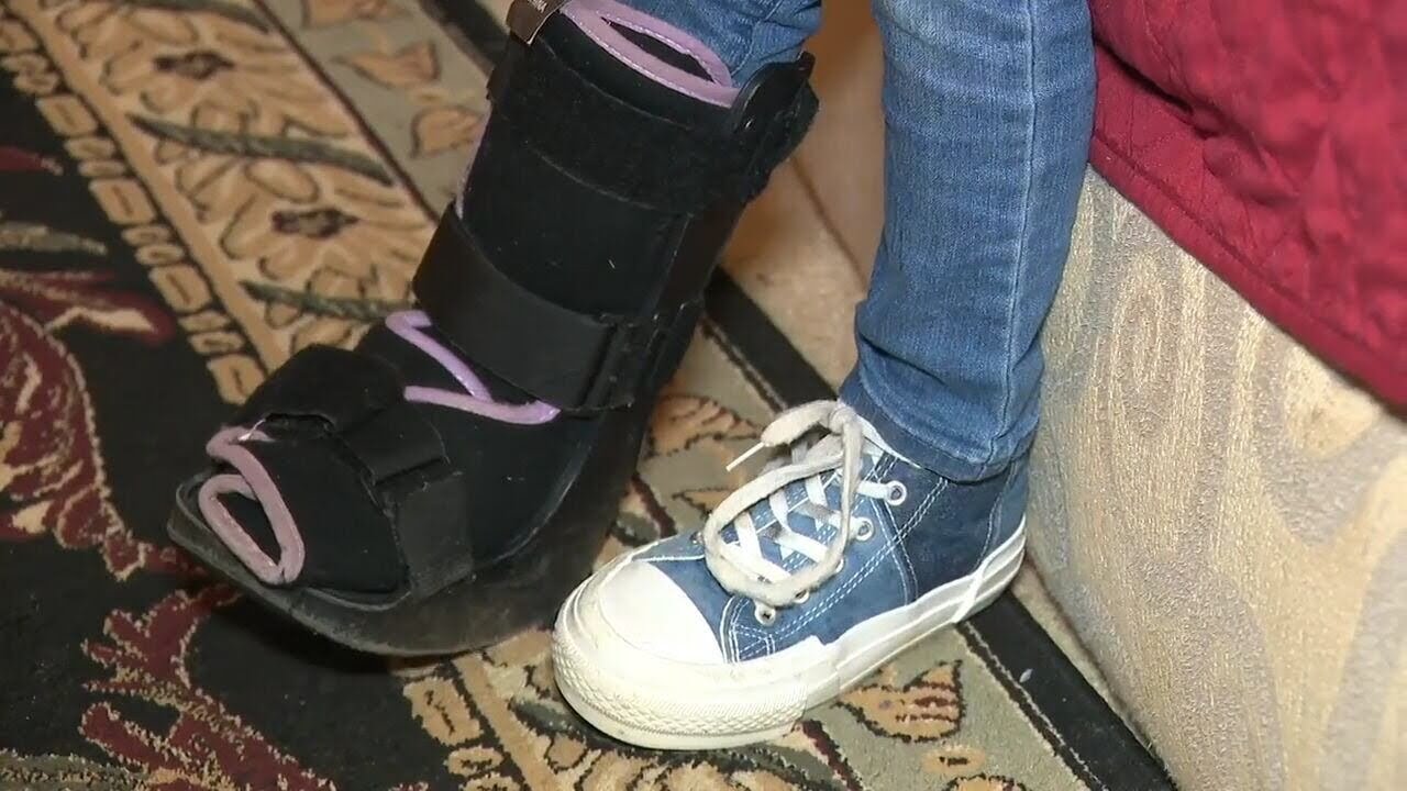 4-year-old broke her toes at daycare, but mom says no one ever called her | WSB-TV