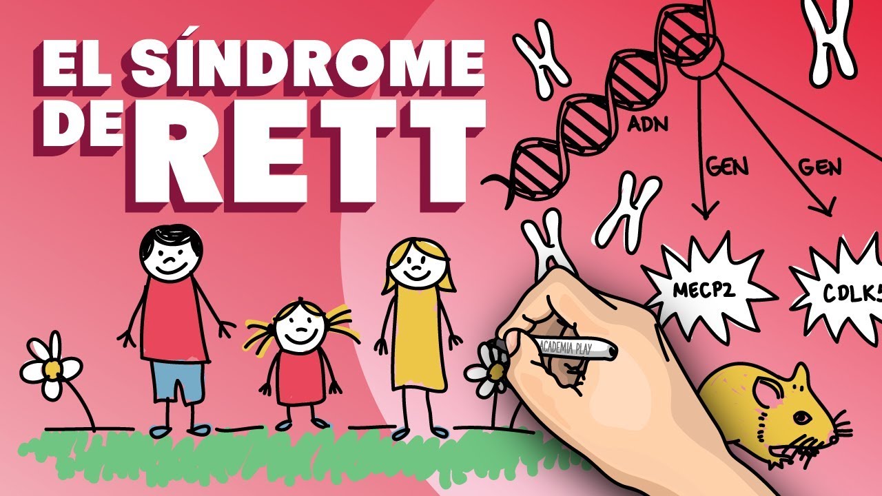 Síndrome de Rett