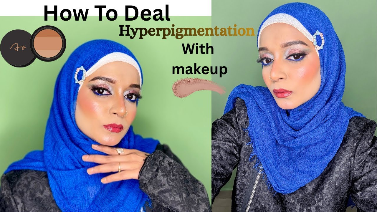 How To Hide Discolouration With Makeup🎨|Right Way To Use Corrector & Concealer|Bule Smokey Effect