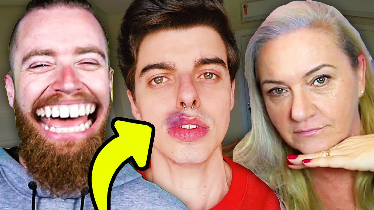 Meu BOTOX deu ERRADO ft @LubaTV e Tia Carminha