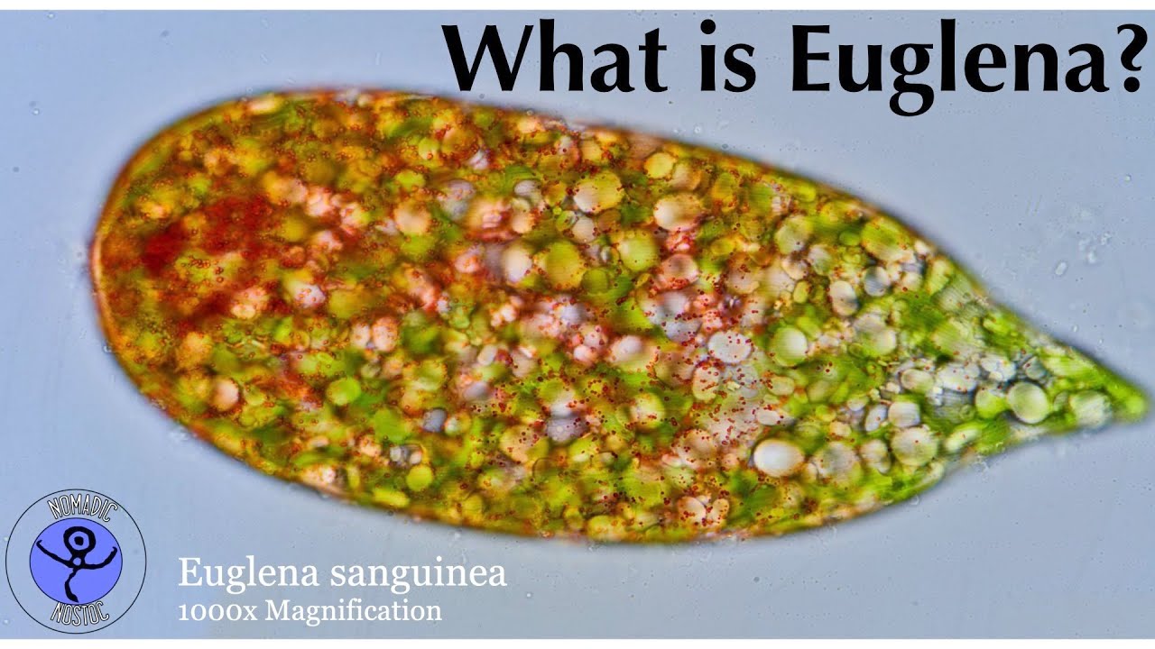 Not animal and not plant? What are you, Euglena?