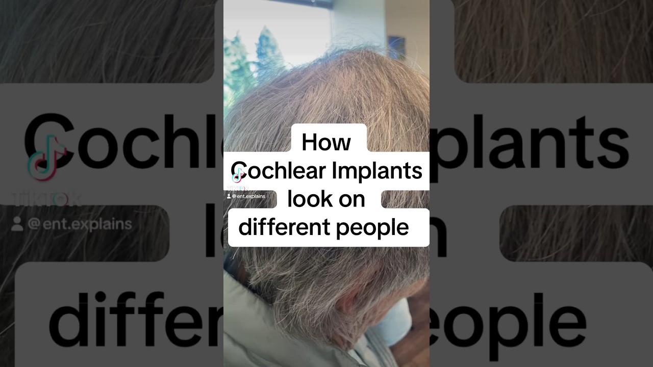 Cochlear Implant Appearance. ENT&rsquo;s favorite surgery #cochlearimplant