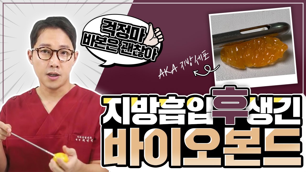 지방흡입 후 부작용😥 바이오본드가 생기는 이유와 빠르게 해결할 수 방법까지 | 지방흡입 부작용 / 팔뚝지방흡입부작용/복부지방흡입 부작용/이중턱지방흡입부작용/지방흡입 바이오본드
