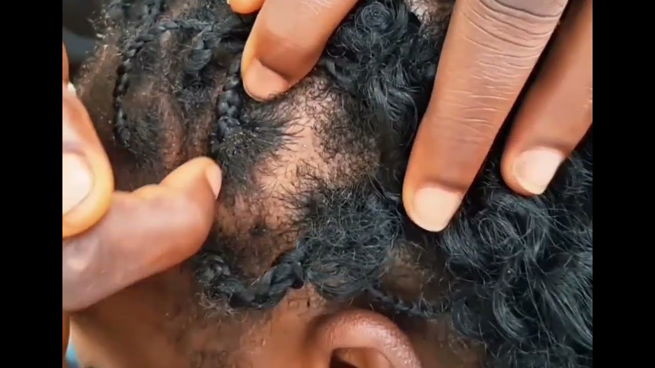 ASMR 😴  braids scratching, scalp check with a satisfying gum cracking 