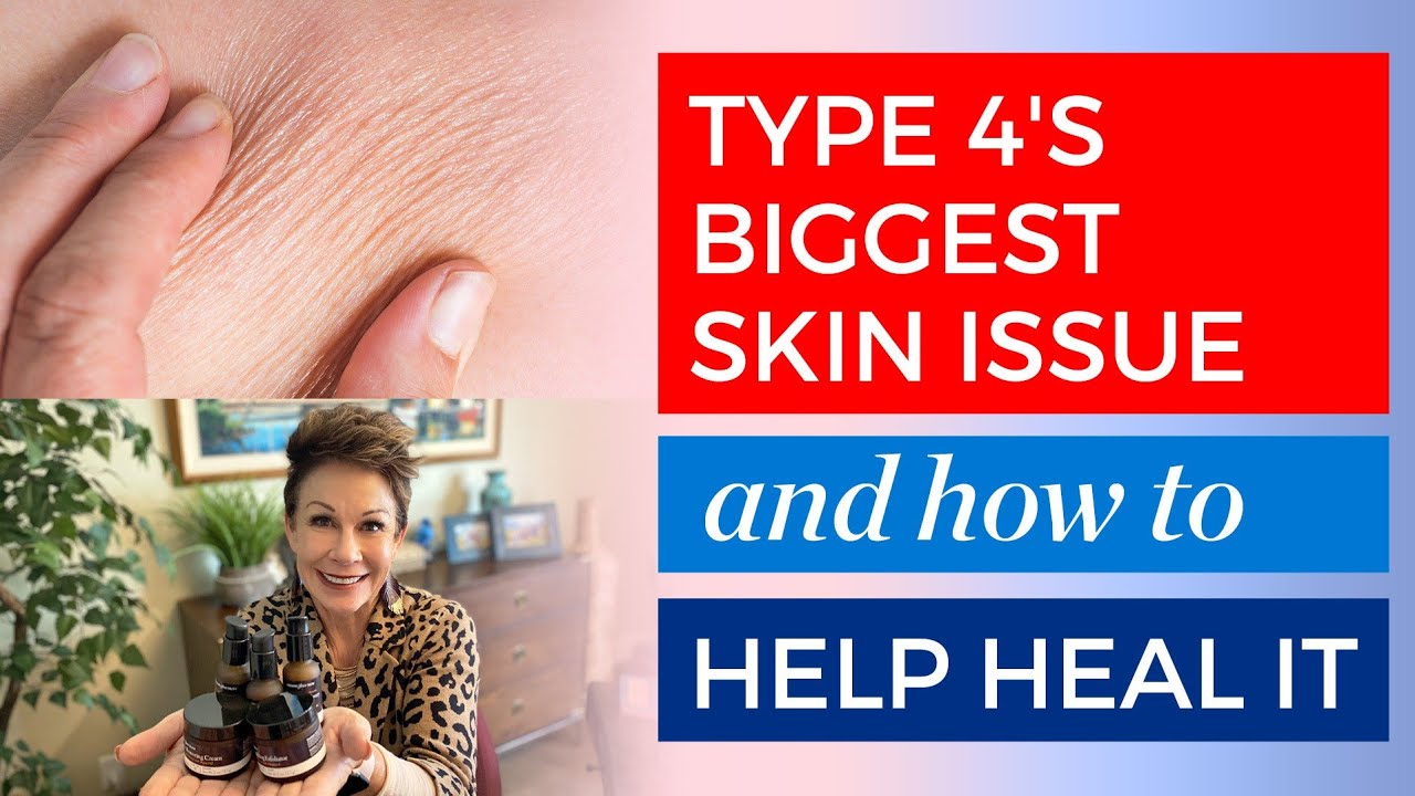 Type 4: How to Treat Crepey Skin Naturally | Carol Tuttle