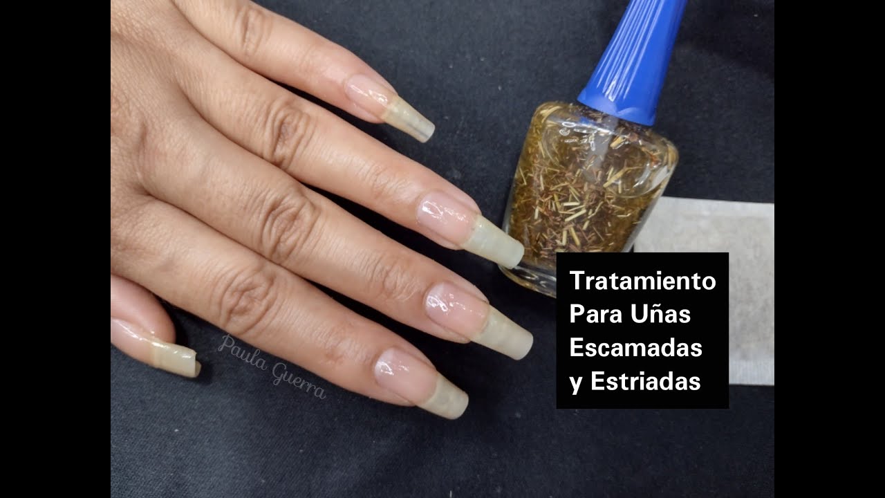 TRATAMIENTO NATURAL PARA UÑAS ESCAMADAS Y ESTRIADAS
