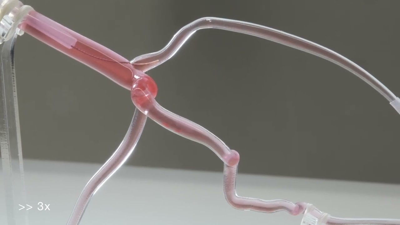 Dexterous helical magnetic robot for improved endovascular access (Supplementary Video 4)