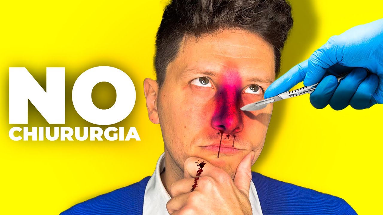 Rinofiller Naso: cos'è, quanto costa e come funziona - Dott. Claudio Maestrini