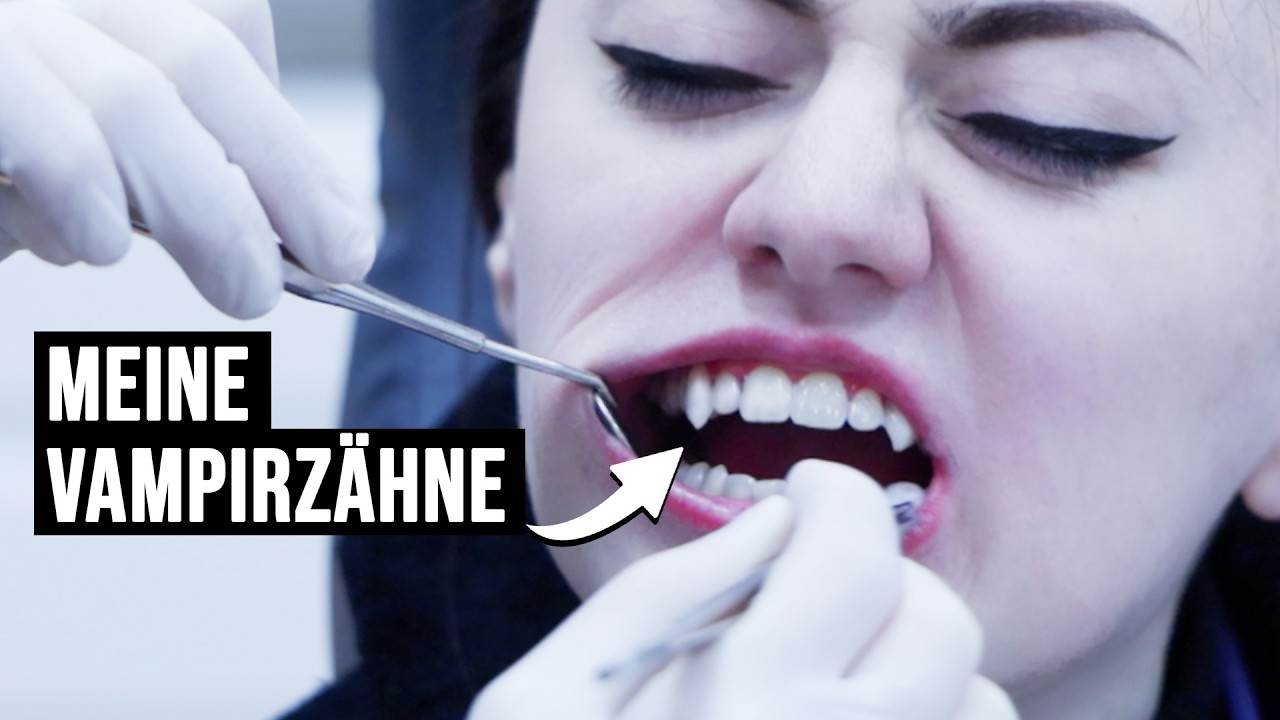 Ich hab mir permanente Vampirzähne machen lassen! | Vlog und Q&A mit meiner Zahnärztin