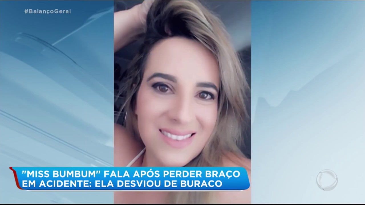 Miss Bumbum que teve braço amputado dá entrevista pela 1ª vez
