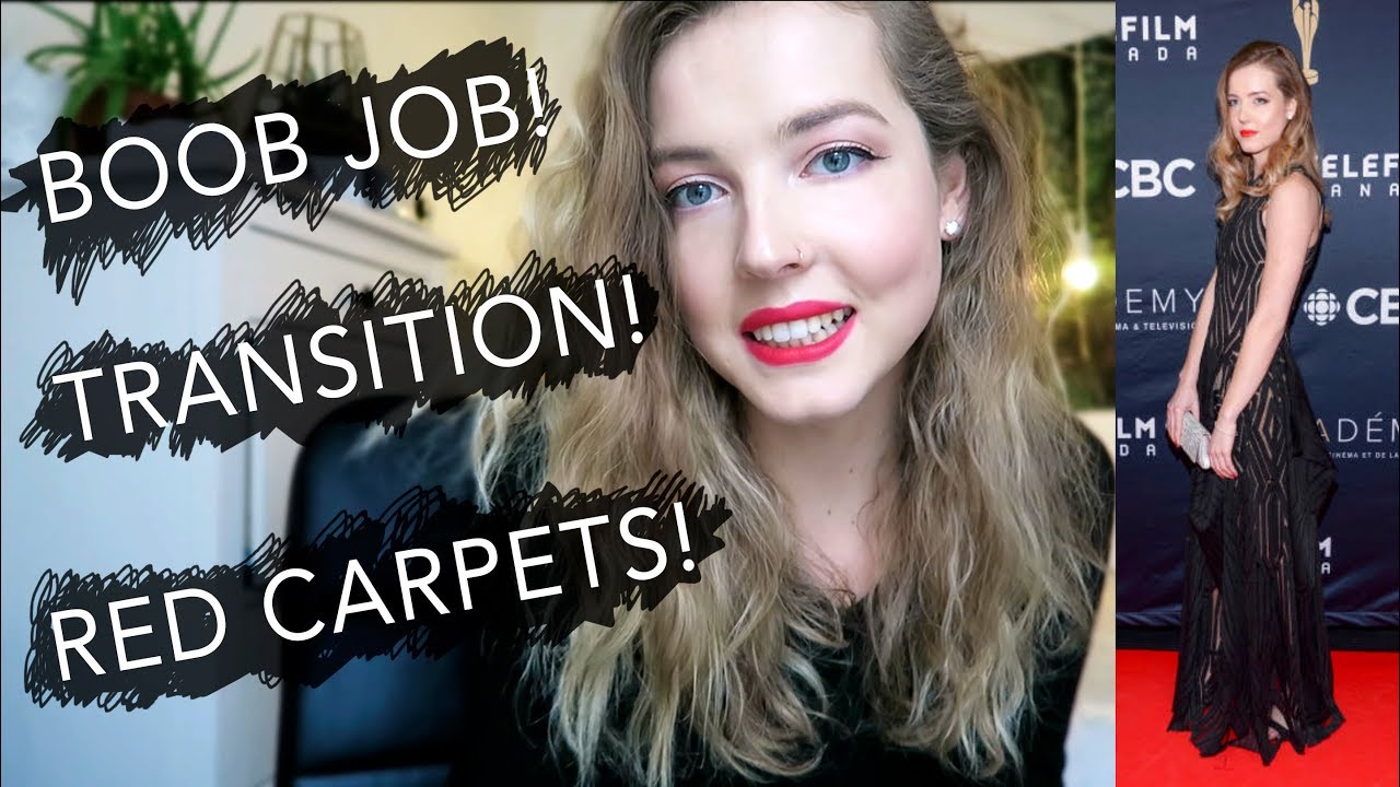 Surgeries, Transition, Red Carpets & More!