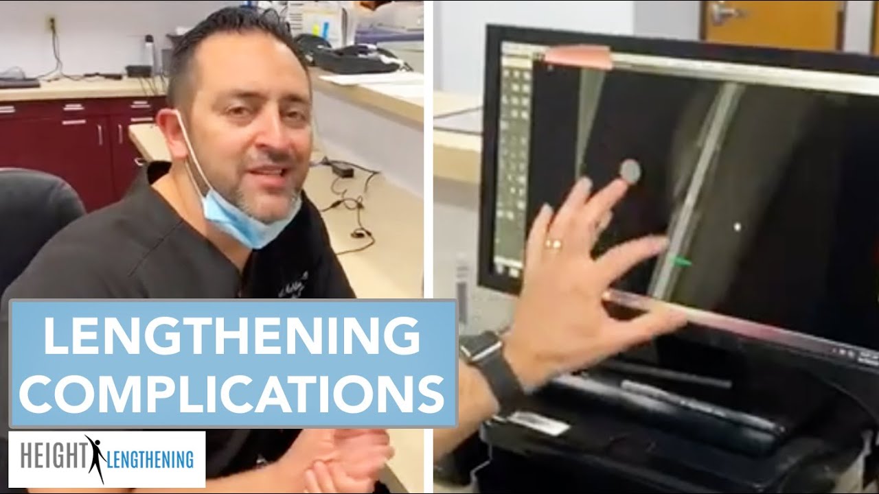 How We Identify & Fix Complications from Leg Lengthening Surgery | Dr. Mahboubian