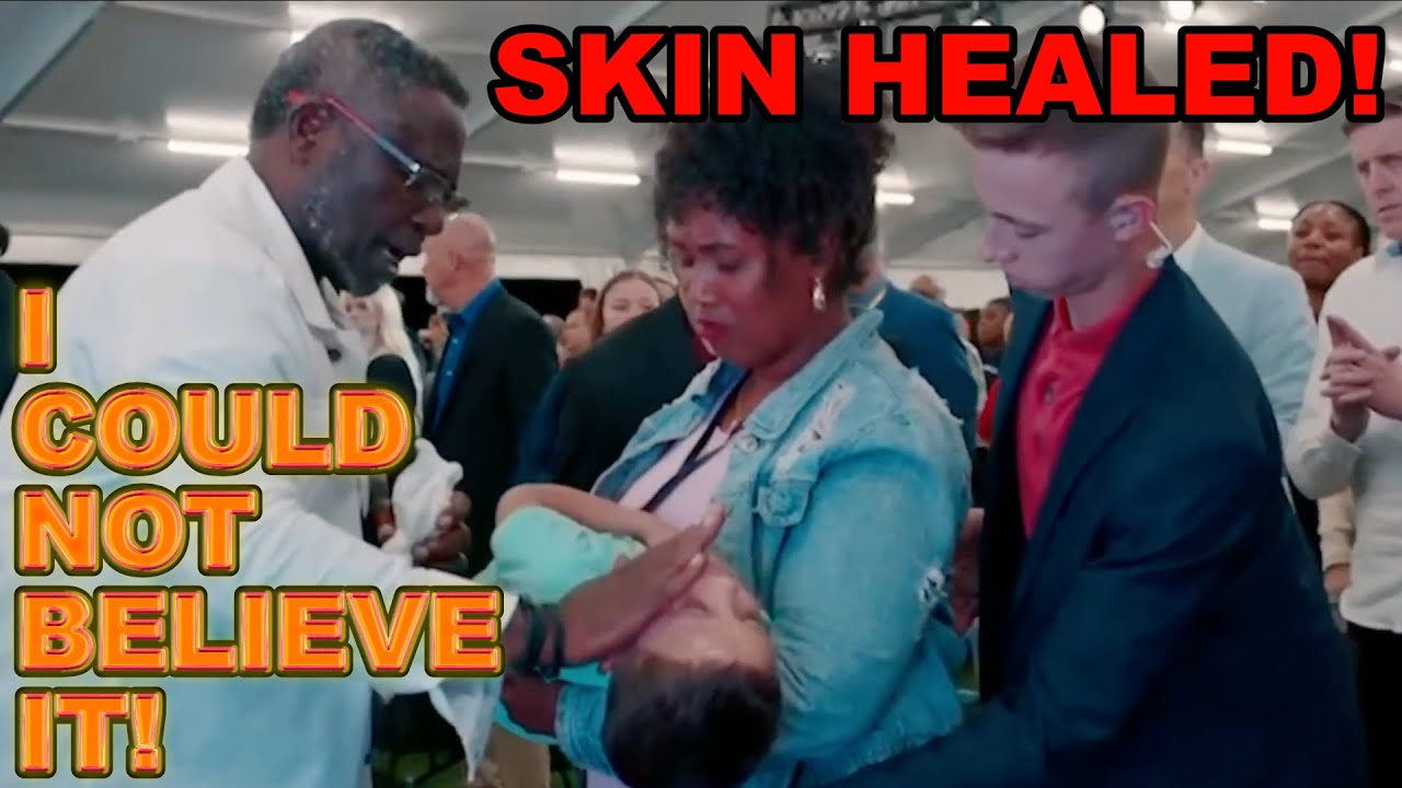 GOD HEALS YOUNG BOY of Skin Condition After Pastor Matthew Ashimolowo Prays Over Him