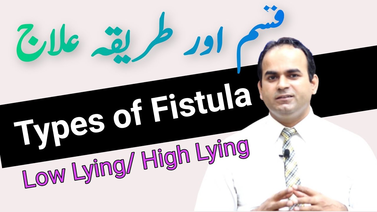 Anal Fistula Types & its Treatment | Surgeon Dr Imtiaz Hussain