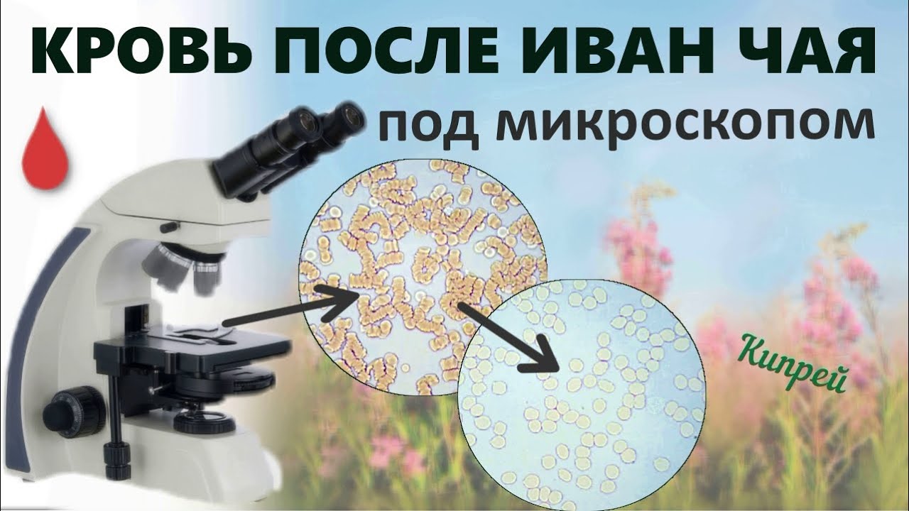Как употребление ИВАН ЧАЯ влияет на состояние крови 👍