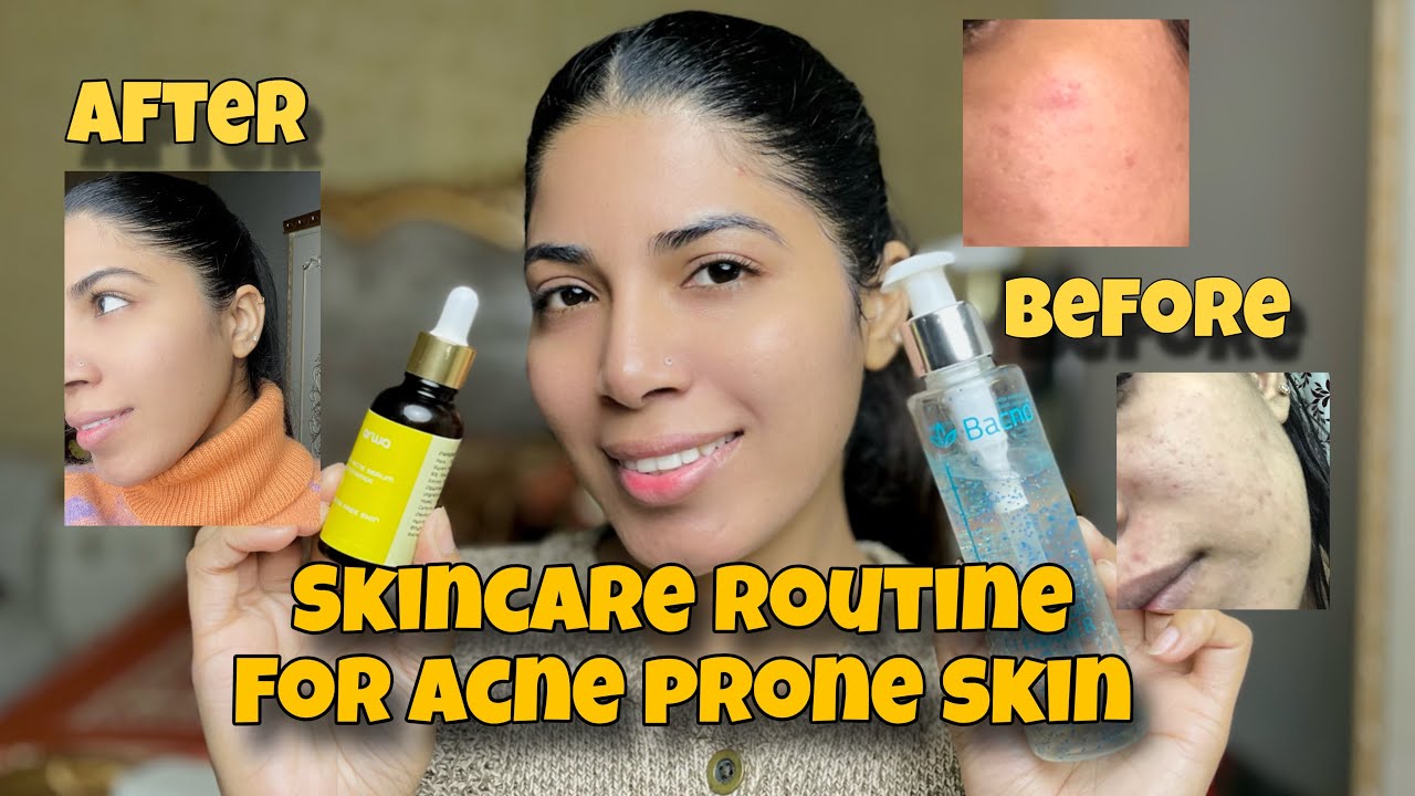 Skincare Routine for Acne-Prone Skin | Morning & Night Routine✅