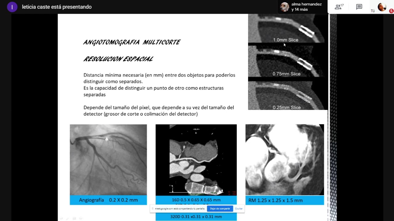 Angiotomografía Coronaria