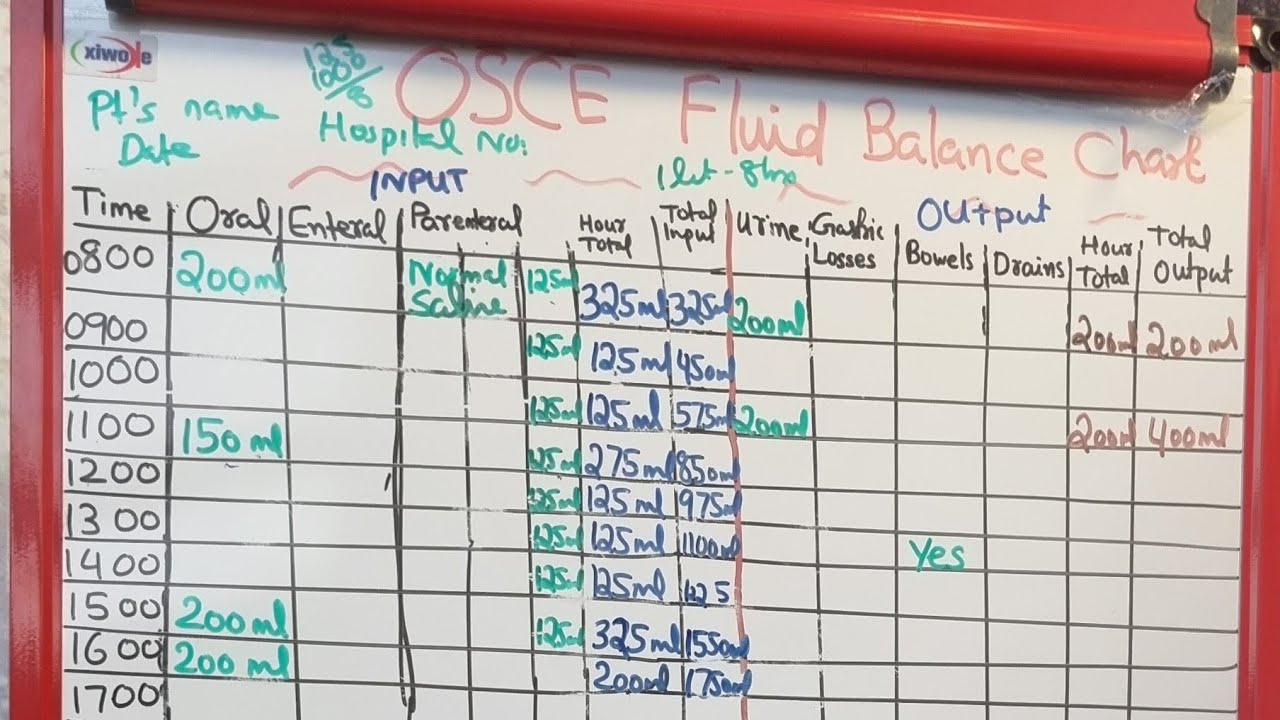Fluid Balance Chart in OSCE exam for Nurses in the Uk/OSCE Silent skill Station for Nurses