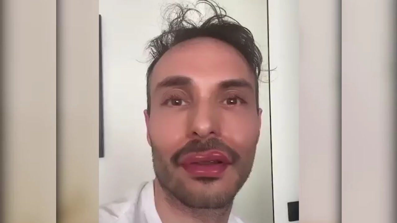 Jérôme Niel - Rémi influenceur 😂😂