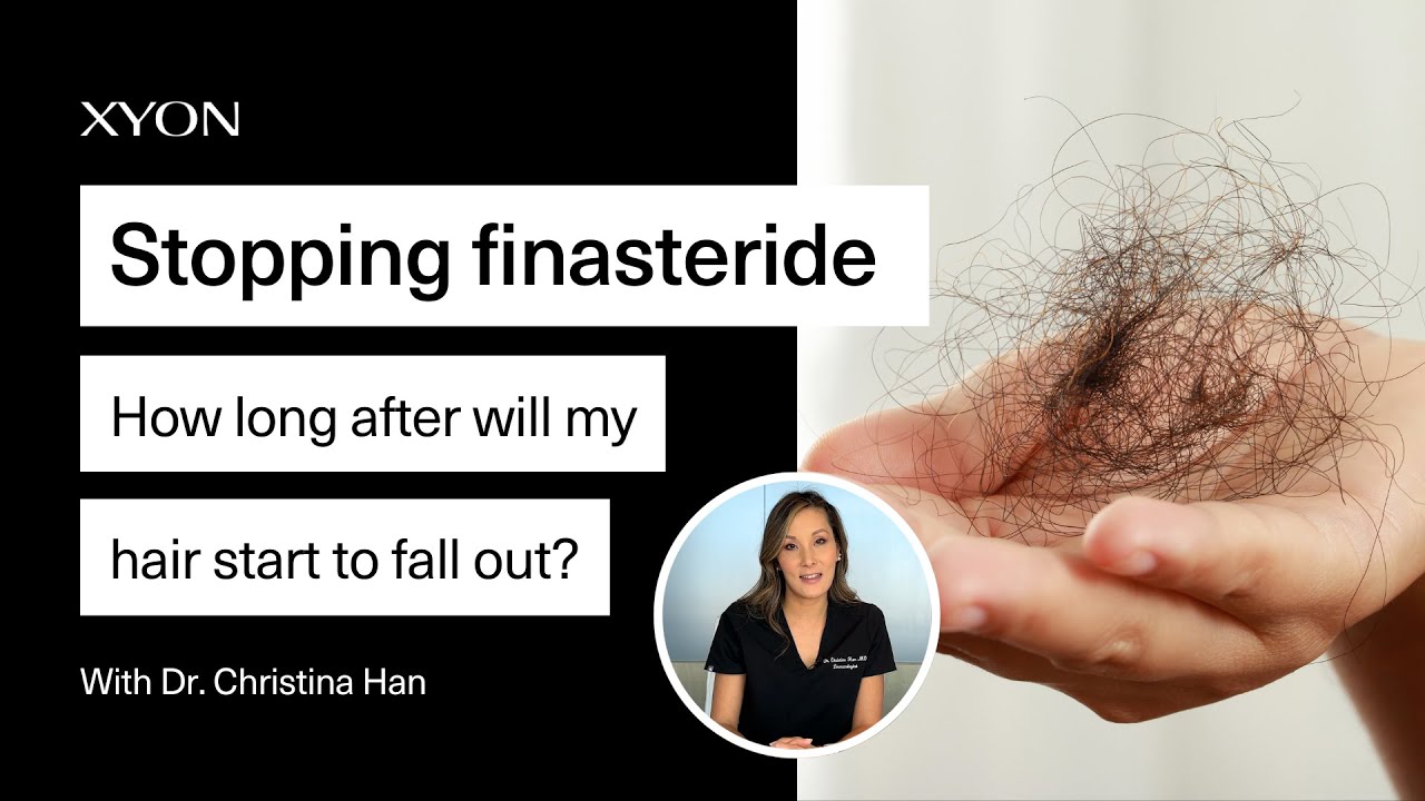 Stopping Finasteride | How long after will my hair fall out?