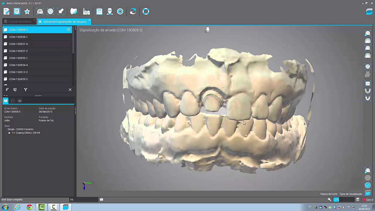 Copping Anatômico - Dental Wings