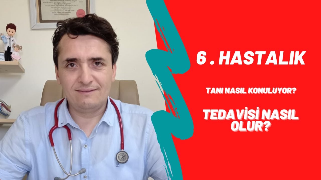6 . Hastalık Tanı ve Tedavisi ✓  Roseola Infantum