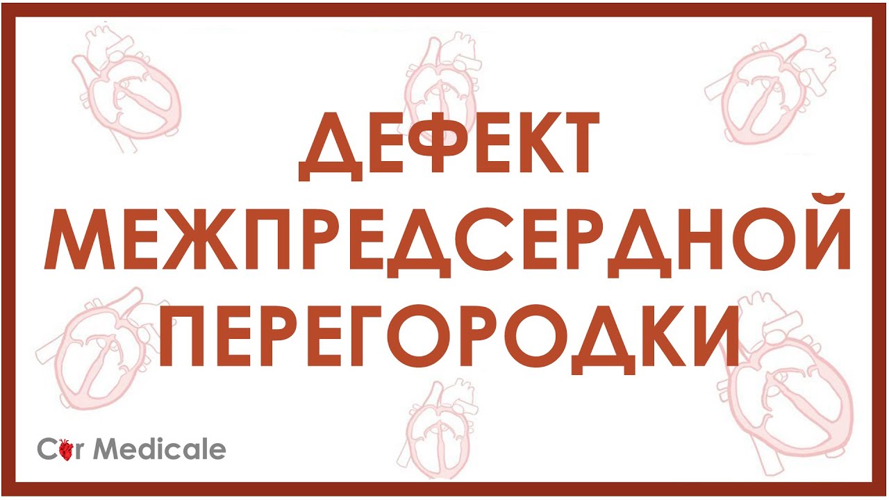 Дефект межпредсердной перегородки: что такое, механизм развития, симптомы и осложнения - кратко