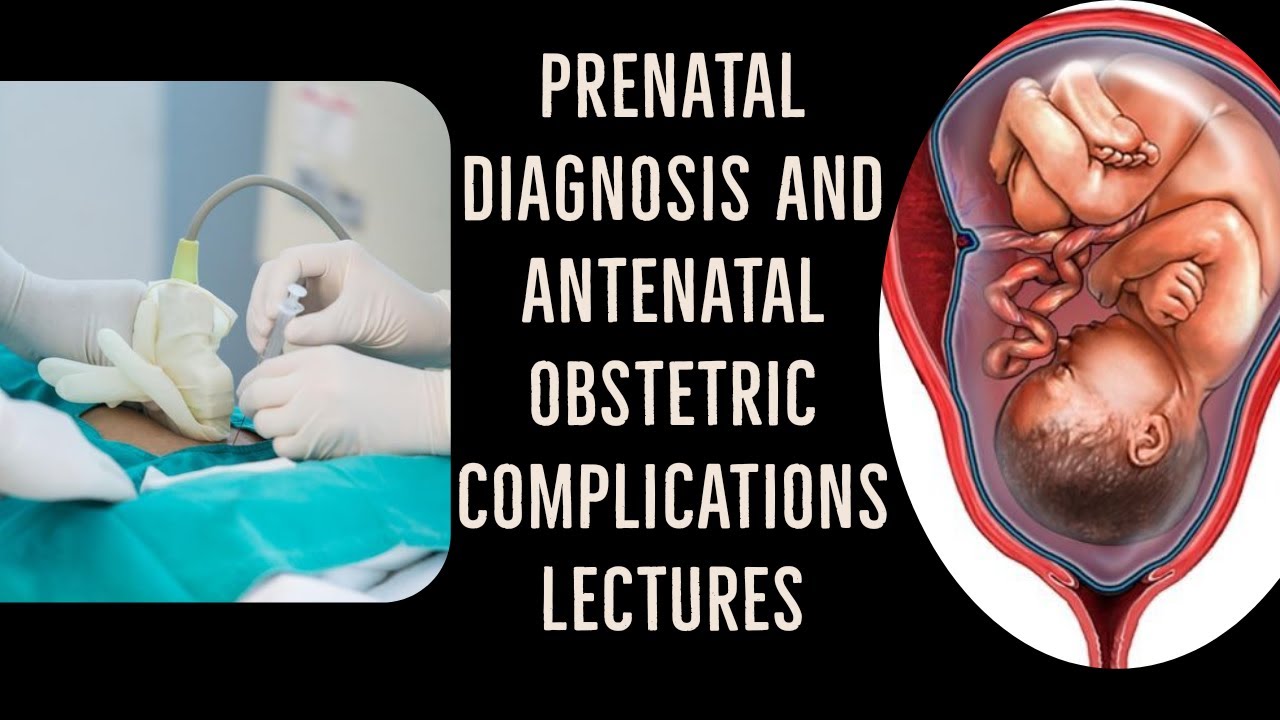 PRENATAL DIAGNOSIS lecture 1 NON INVASIVE tests and CHORIONIC VILLOUS SAMPLING made easy