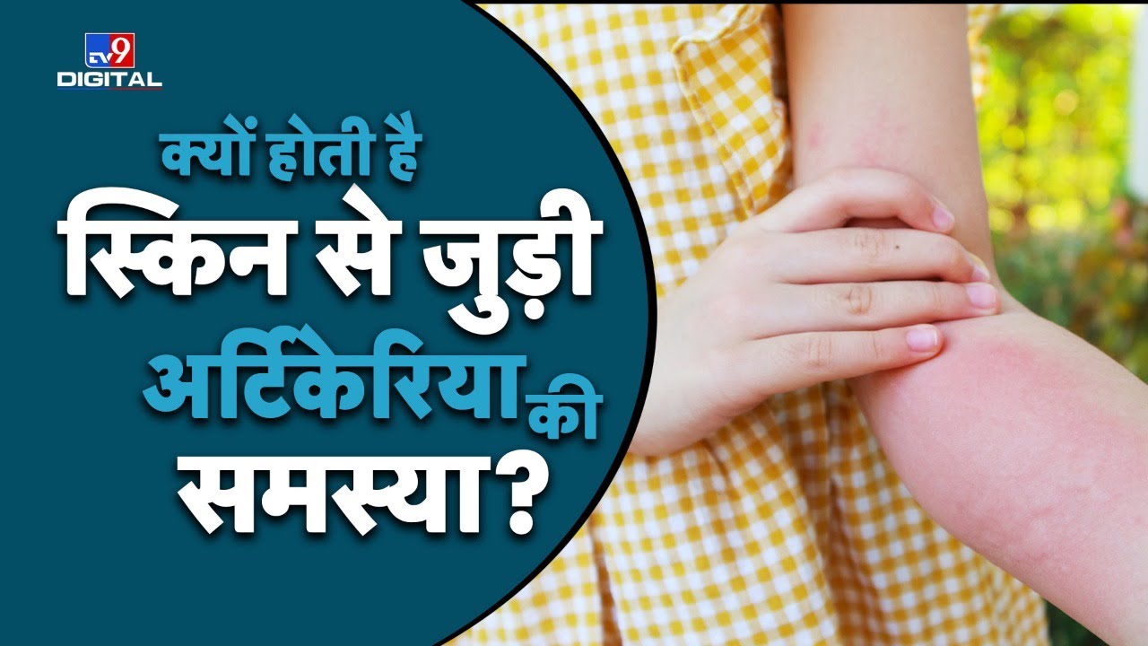 क्यों होती है Skin से जुड़ी Urticaria की समस्या ? जानिए DR. Gunjan Verma से