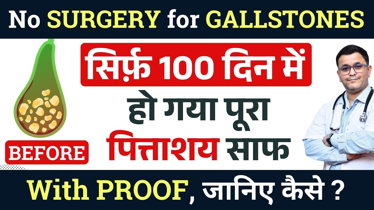 BEST 2 Homeopathic MEDICINE for Gallstones TREATMENT without SURGERY