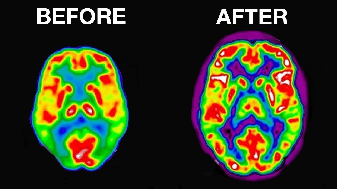 How I Did 40 Years Of Meditation In 5 Days