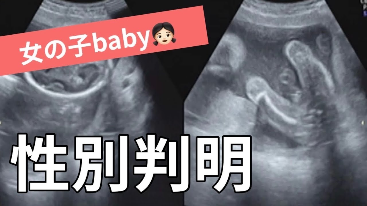 【エコー動画あり】性別判明！女の子baby👶