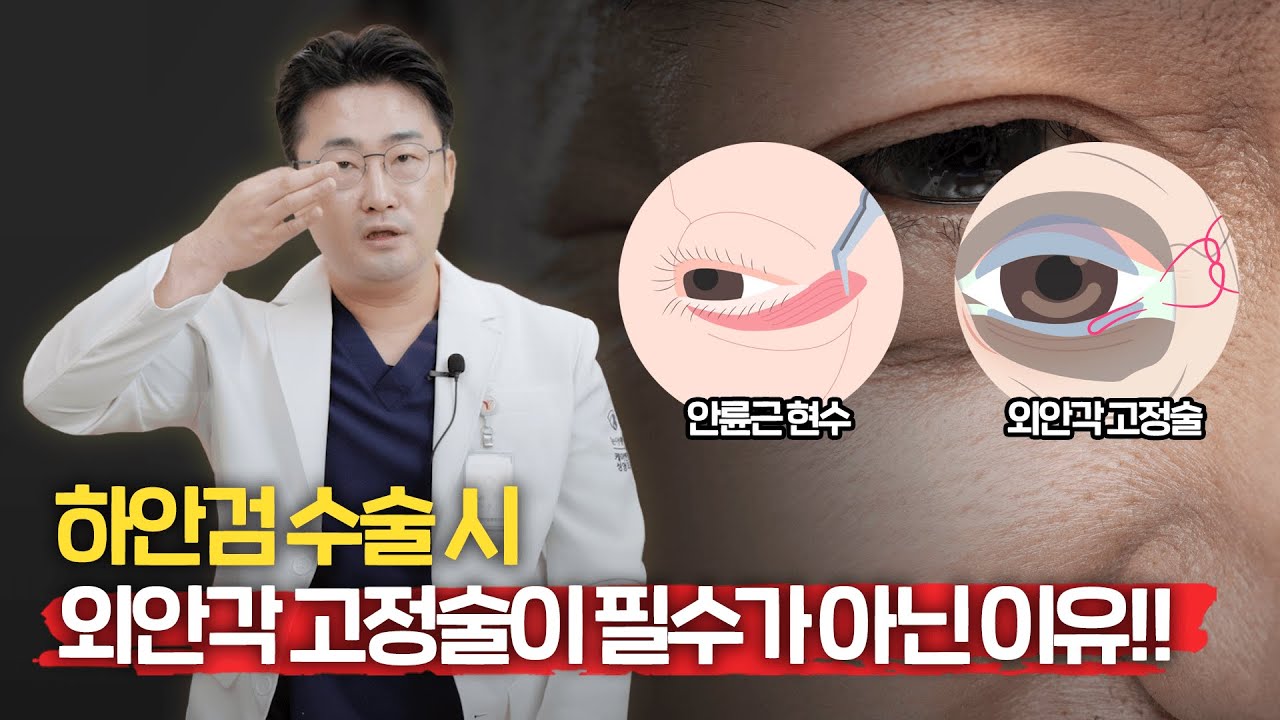 하안검 수술 시, 외안각 고정술..?많은 분들이 착각하고 계십니다!!!_[부산 케이엔젤 성형외과]