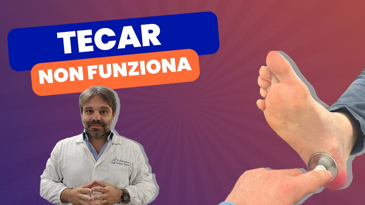 3 MOTIVI per cui la TECAR è INUTILE per la FASCITE o la TALLONITE