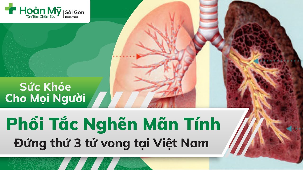 Phổi tắc nghẽn mãn tính | Nắm chắc Nguyên nhân, Triệu chứng, Biến chứng