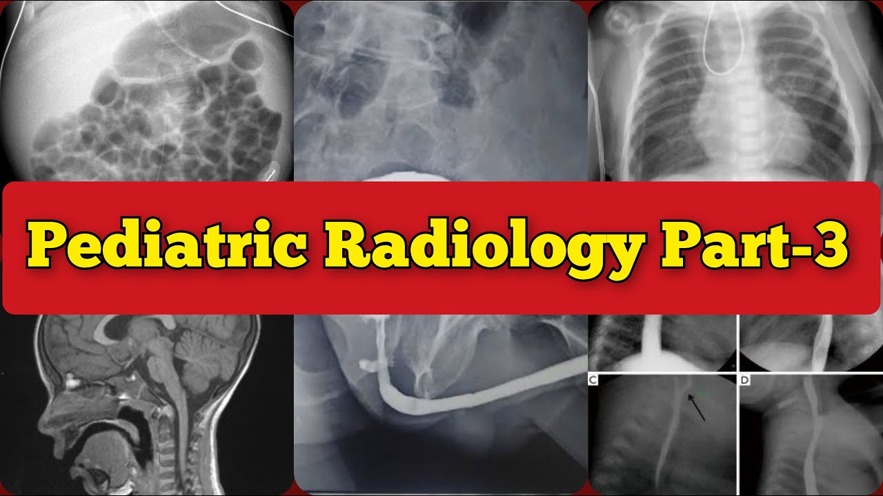 Radiology Viva Cases # 287-300 | Exam Cases of Pediatrics Radiology Part-3 #medical #radiology