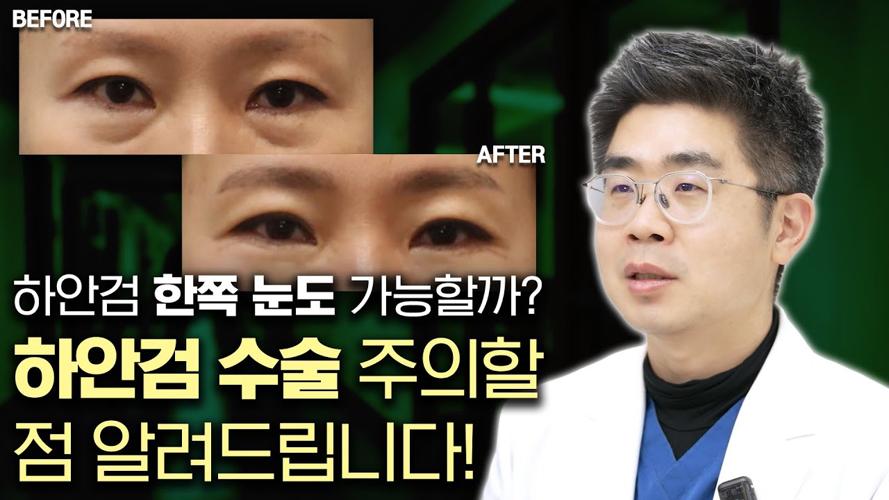 하안검 한쪽 눈도 가능할까?👀 하안검 수술 주의할 점 알려드립니다!