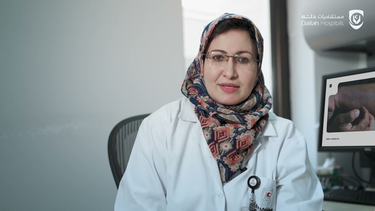 مرض الصدفية وطرق علاجه