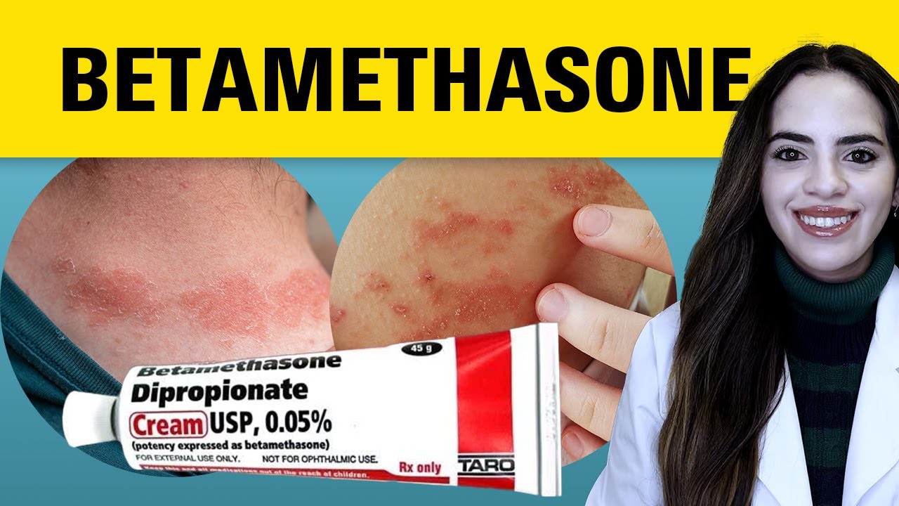 What you need to know about Betamethasone?