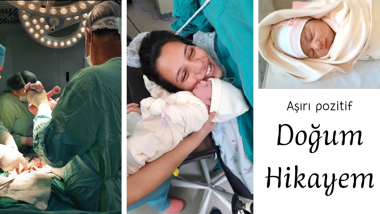 Aşırı pozitif doğum hikayem | 39+4 Epidural Sezaryen