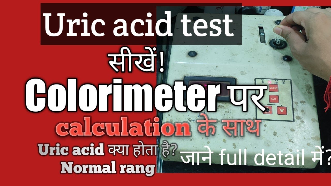 Uric acid test in colorimeter and calculations  full details