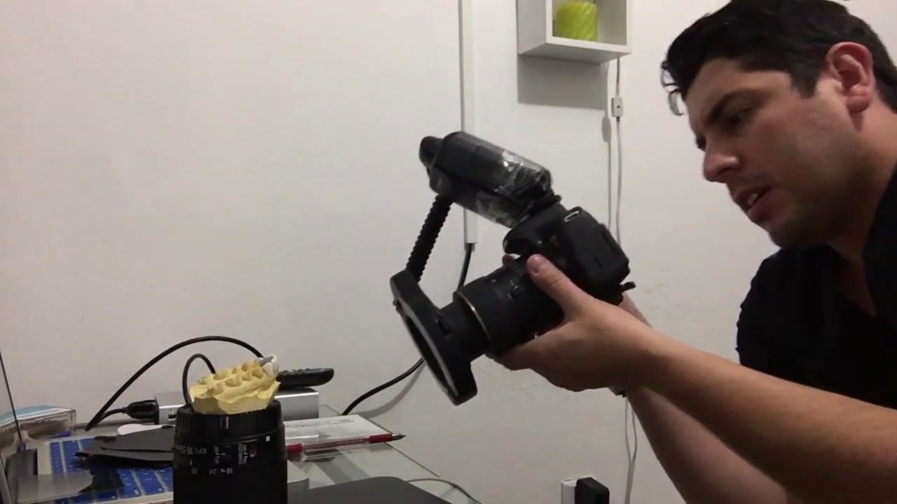 Tips de Fotografía Dental, usando el Ring Flash