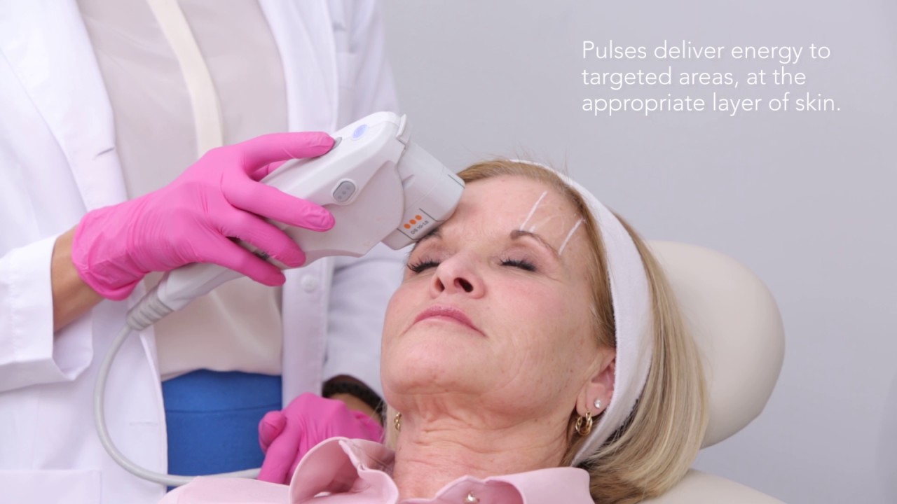 Ultherapy