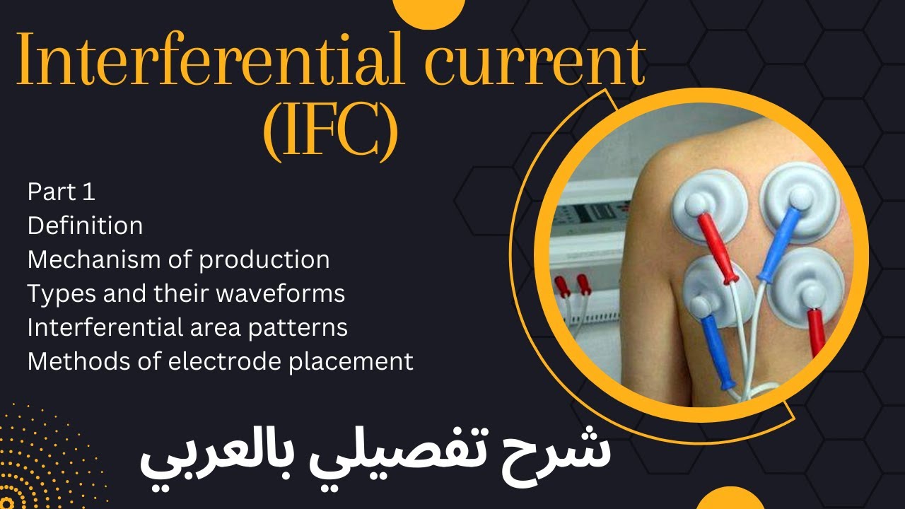 Interferential current (IFC)شرح تفصيلي بالعربي