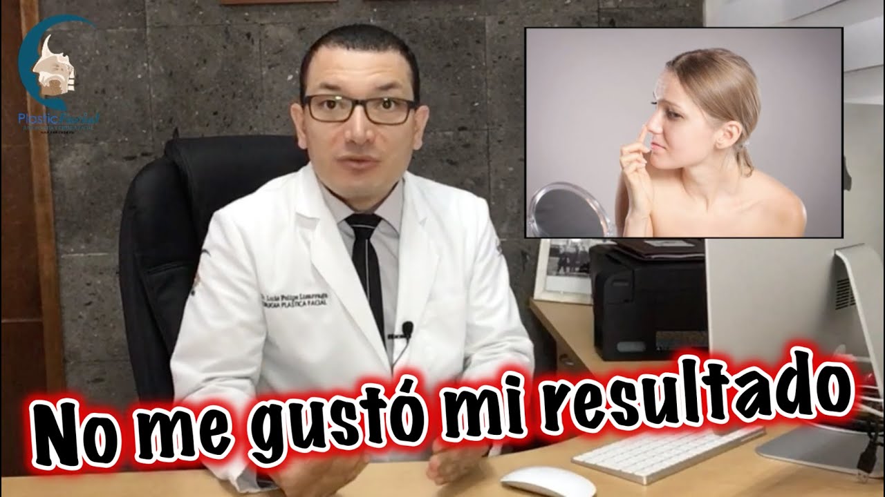 El resultado de mi RINOPLASTÍA no fue el que esperaba 😢¿Qué puedo hacer?