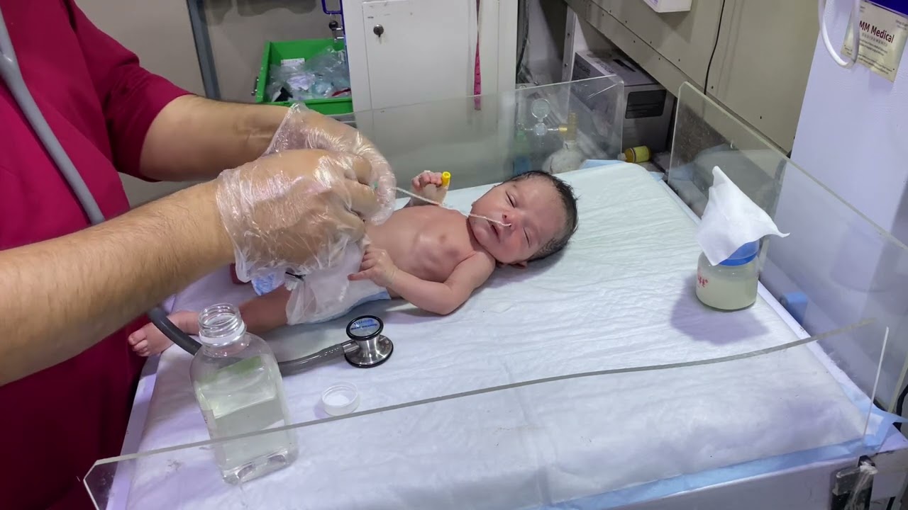 ❤️Adorable NICU Baby | Poor Sucking Reflex & NG Tube Feeding Support#neonatologist #neonatalicu #