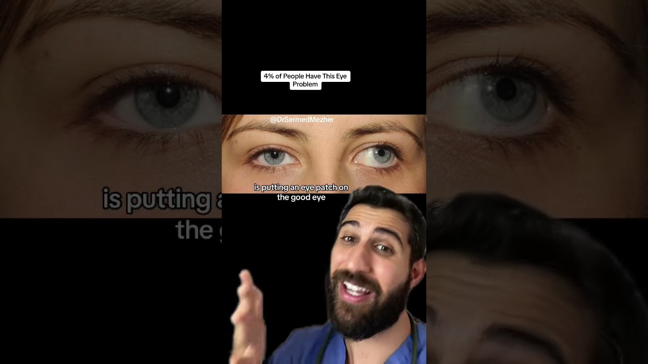 4% of People Have This Eye Problem #squint