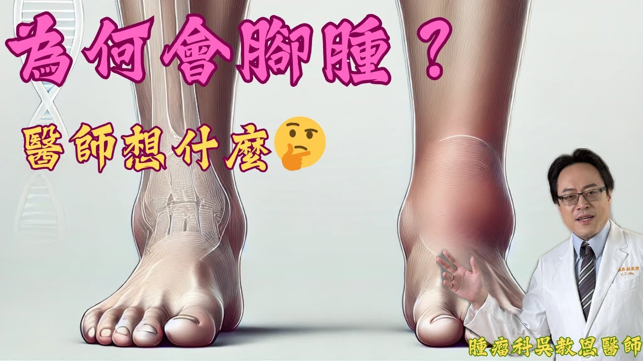 腳腫怎麼辦？從臨床醫師的角度解析常見原因與應對方法 Leg edema: Clinical Insights into Common Causes and Treatment Approaches